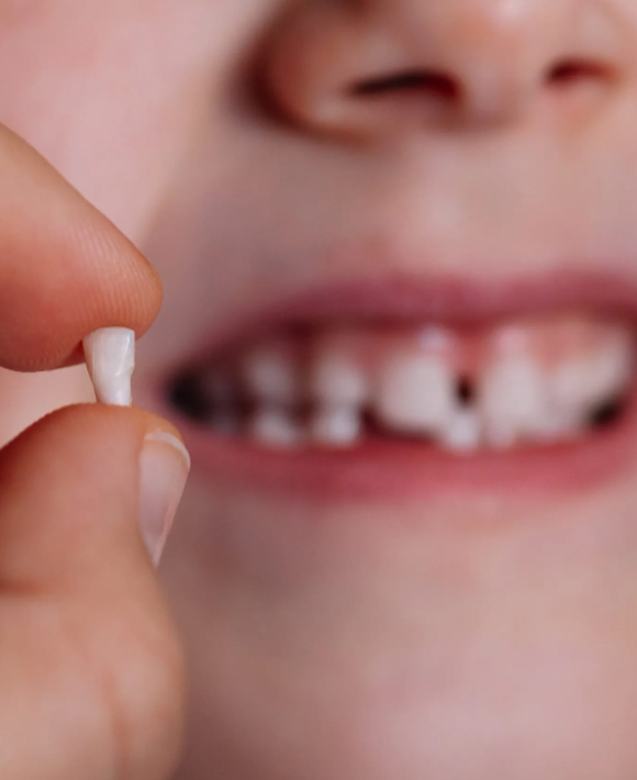 Tooth Extraction For Kids Dentist in Cochrane, AB - Grande Dentistry