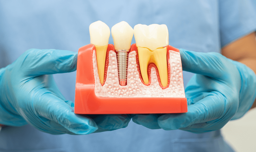 How Dental Implants Can Improve Your Oral Health and Confidence