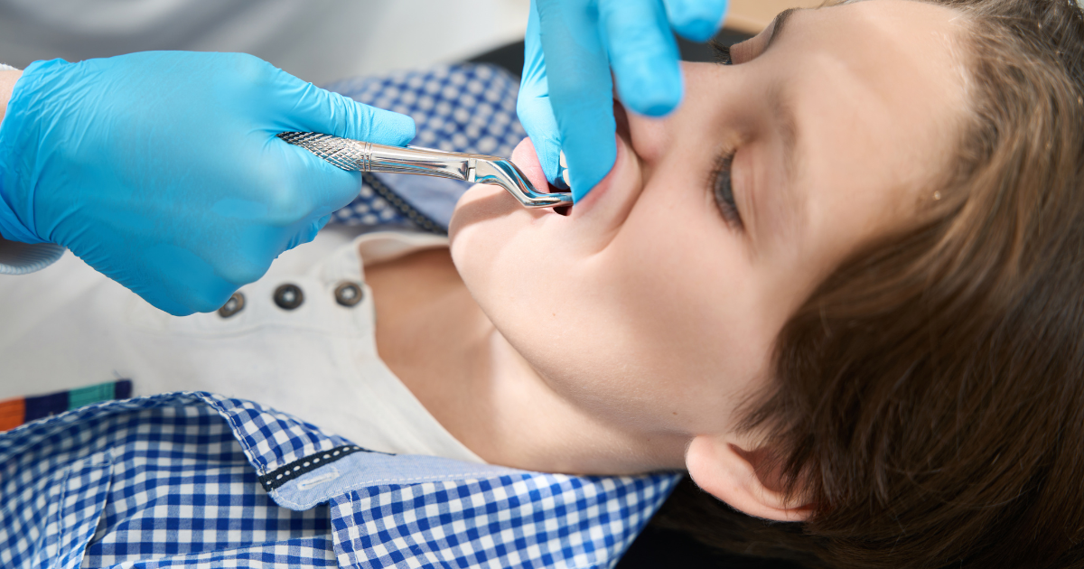 Essential Post-Tooth Extraction Care for Kids