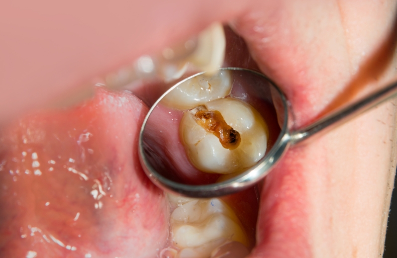 is a dental infection a life-threatening emergency