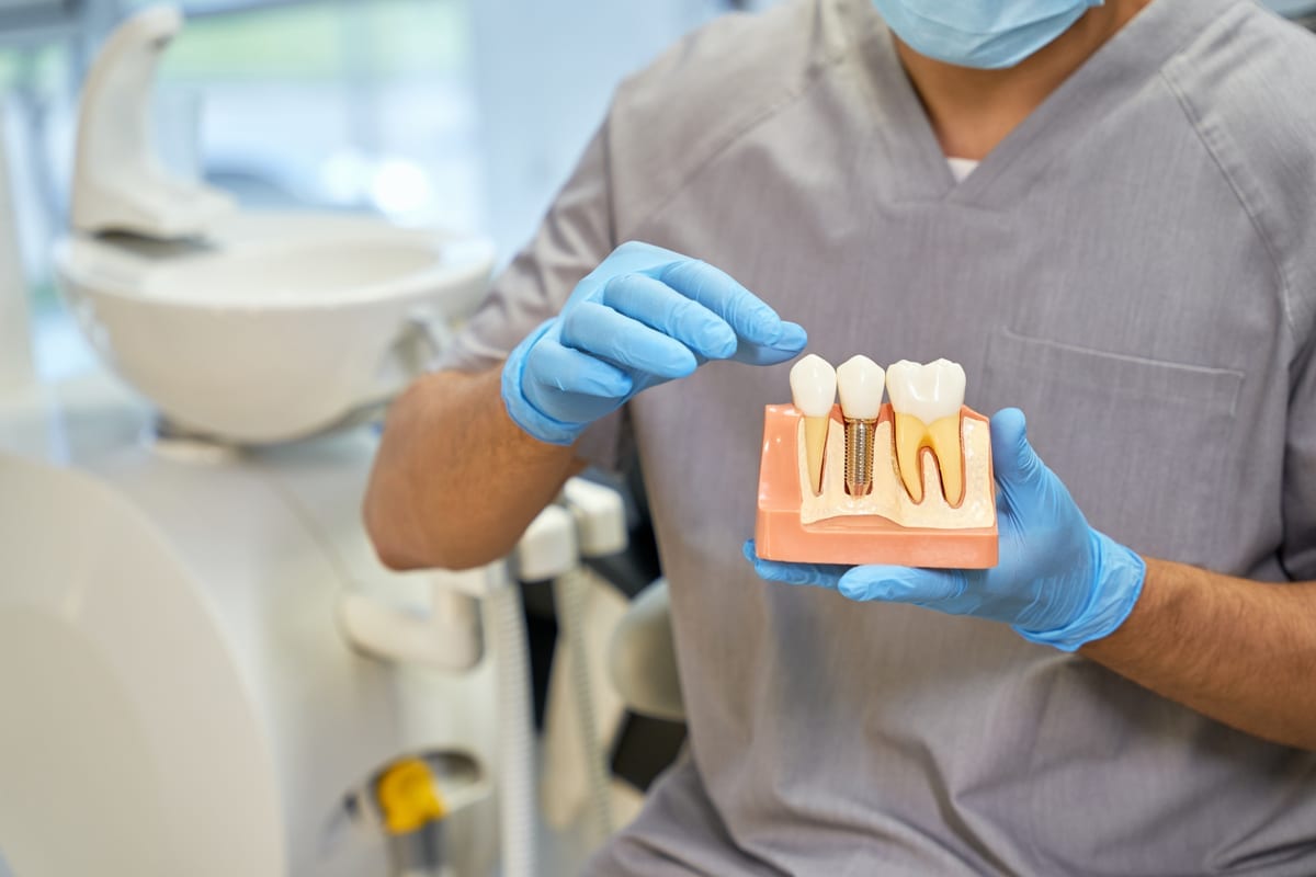 Dental Implants in Cochrane