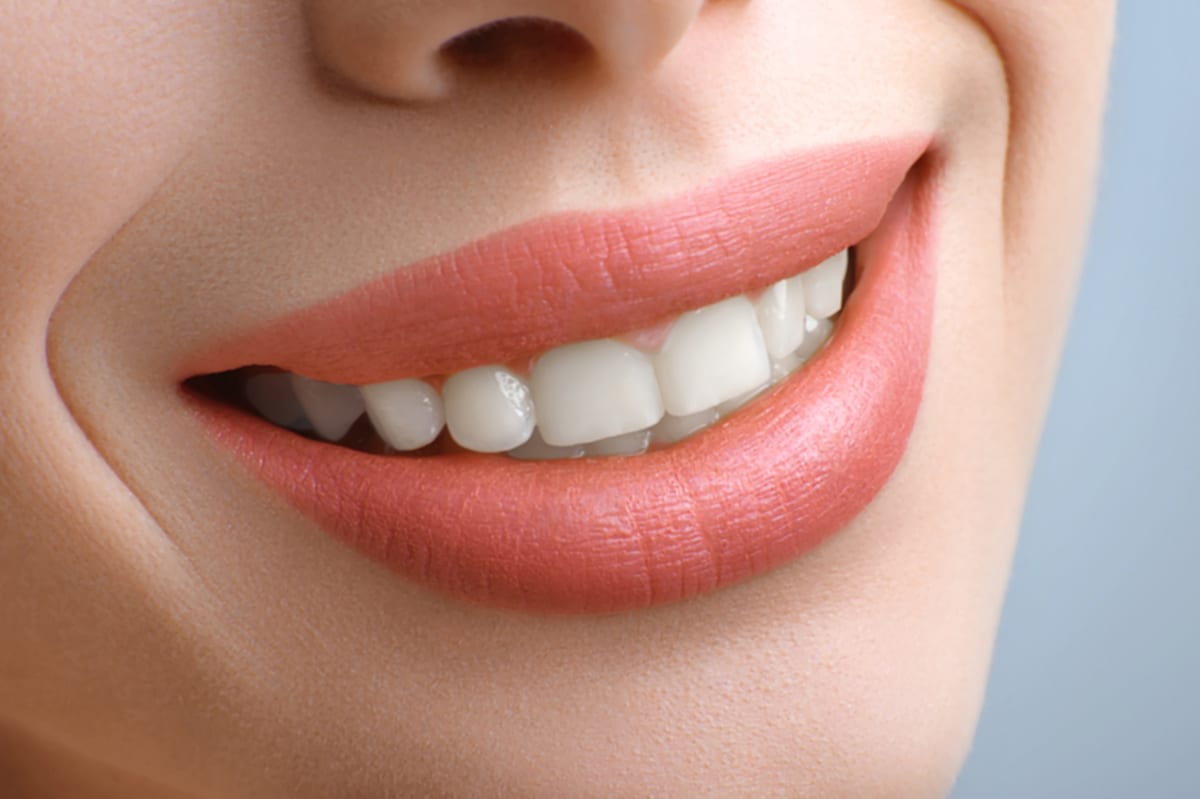 Teeth Whitening in Cochrane