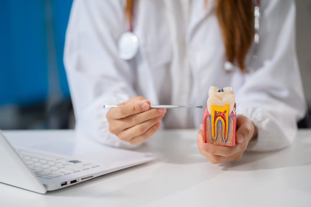 Root Canal Treatment in Cochrane
