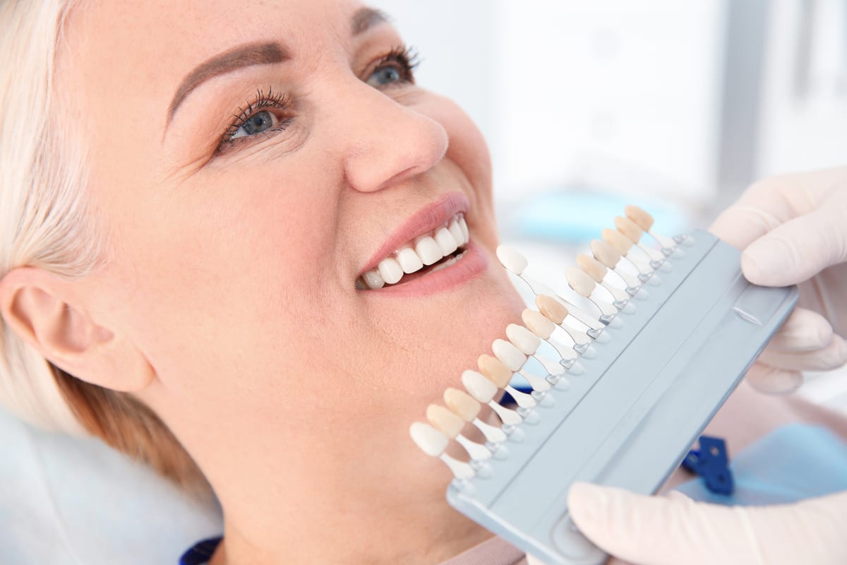 Veneers in Cochrane